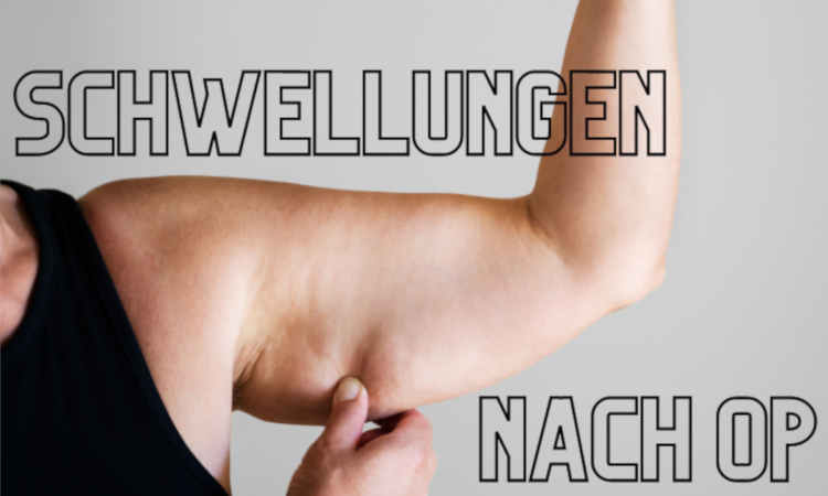 Armschwellung nach Operation